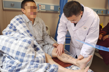 市中医医院帮助甘孜州藏医院开展首例静脉曲张手术